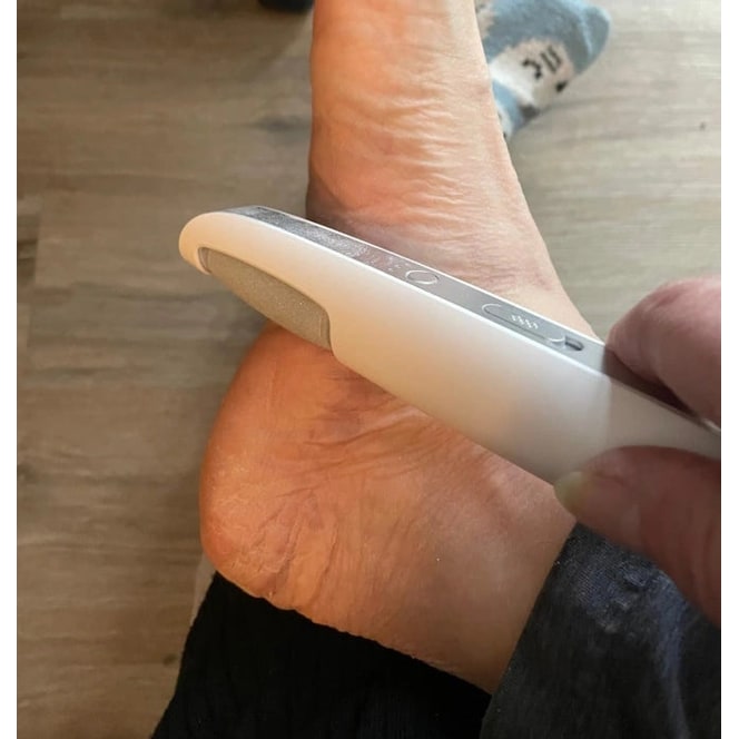 Electric Foot File and Callus Remover with Rechargeable Roller Head