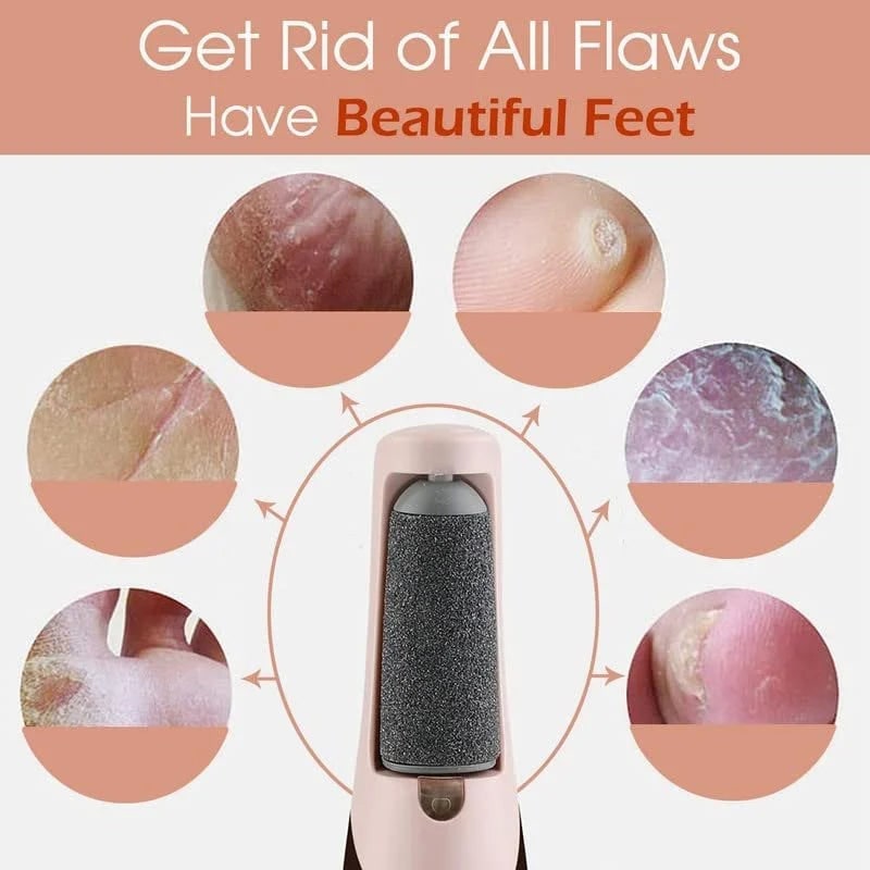 Electric Foot File and Callus Remover with Rechargeable Roller Head