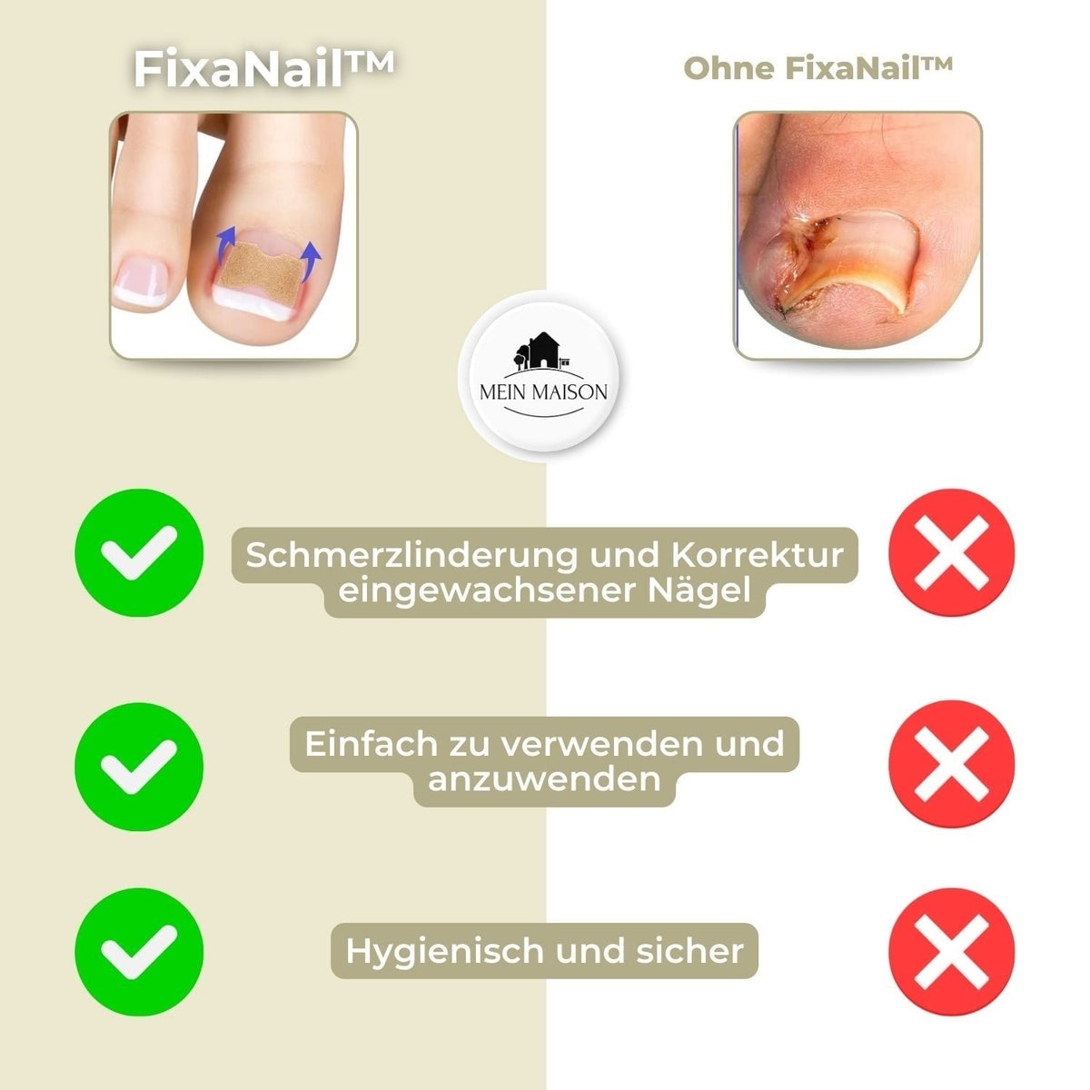 Ingrown Nail Treatment Corrector Patches with Adhesive Peel and Stick Application