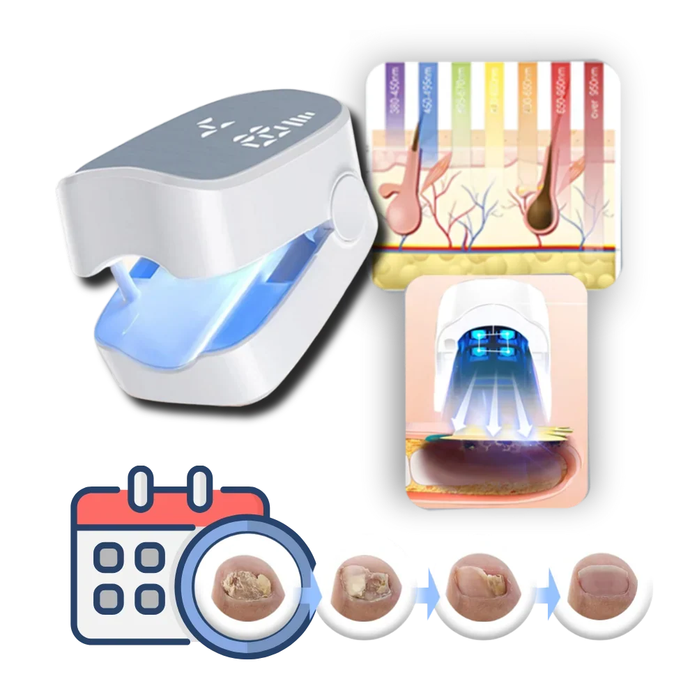 Nail Patch Laser | Dual-Mode Cold & Pulse | USB-Rechargeable