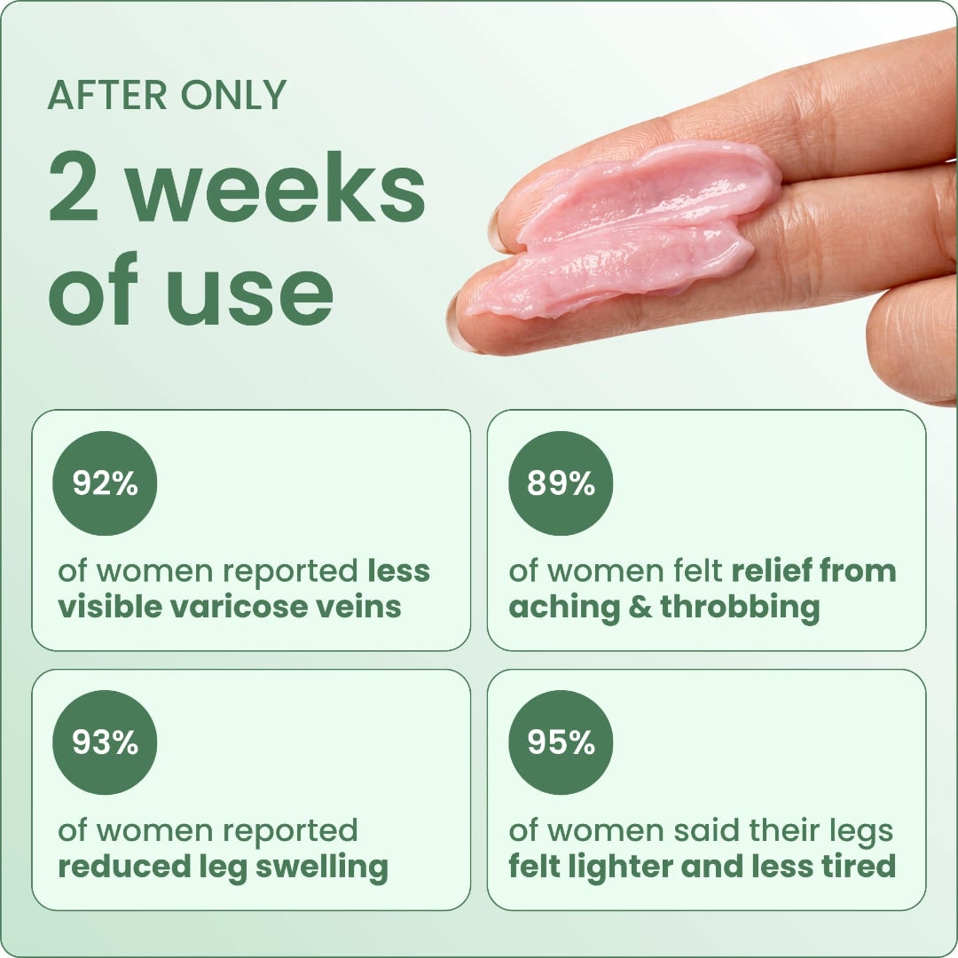 Varicose Vein with Horse Chestnut Arnica Calendula Balm